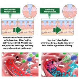 𝑶𝒇𝒇𝒊𝒄𝒊𝒂𝒍 𝑺𝒕𝒐𝒓𝒆 | ✨✨𝑯𝙤𝒑𝐫𝒊𝙢𝒆®𝑴𝒐𝒓𝒊𝒏𝒈𝗮 · 𝗕𝗲𝗿𝗯𝗲𝗿𝙞𝙣𝙚 × 𝙉𝘼𝐃+ 𝟏𝟎-𝐢𝐧-𝟏 𝗔𝗱𝘃𝗮𝗻𝗰𝙚𝙙 𝙉𝙖𝙣𝙤 𝙈𝙞𝙘𝙧𝙤𝙣𝙚𝙚𝐝𝐥𝐞 𝐏𝐚𝐭𝙘𝙝🇺🇸(𝐉𝐮𝐬𝐭 𝐨𝐧𝐜𝐞 𝐚 𝐝𝐚𝐲, 𝐯𝐢𝐬𝐢𝐛𝐥𝐞 𝐜𝐡𝐚𝐧𝐠𝐞𝐬 𝐢𝐧 𝟕 𝐝𝐚𝐲𝐬） ✅ 𝐅𝐨𝐫 𝐨𝐛𝐞𝐬𝐢𝐭𝐲, 🅛🅞🅞🅢🅔 🅢🅚🅘🅝,𝐝𝐢𝐚𝐛𝐞𝐭𝐞𝐬, 𝐬𝐥𝐞𝐞𝐩 𝐚𝐩𝐧𝐞𝐚, 𝐣𝐨𝐢𝐧𝐭 𝐢𝐬𝐬𝐮𝐞𝐬, 𝐚𝐧𝐝 𝐦𝐨𝐫𝐞